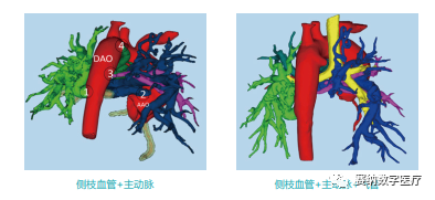 心血管医学3D重建