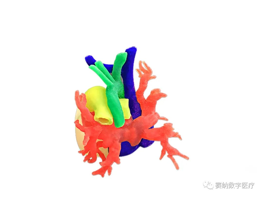 心血管医学3D打印模型