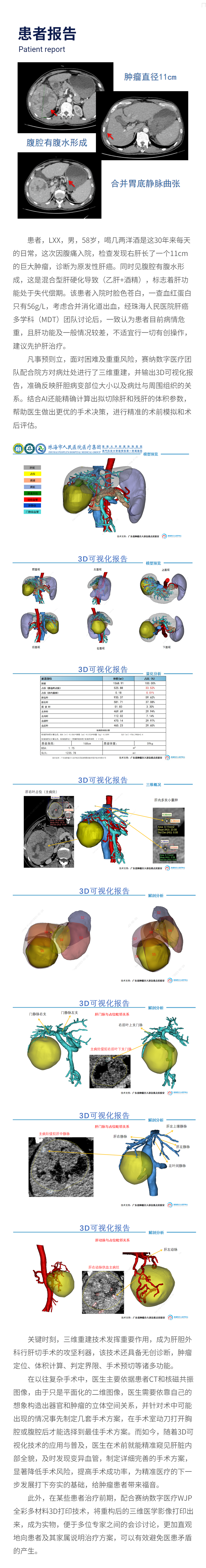 医疗三维重建.png