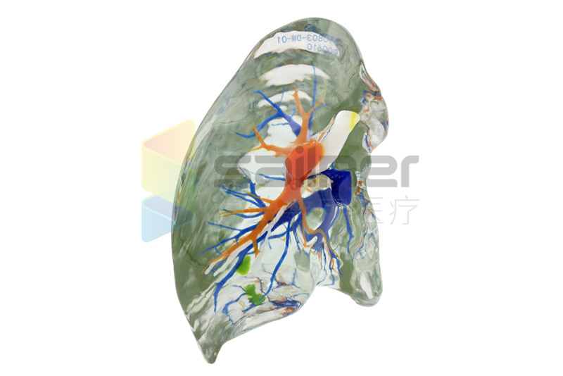 肺脏3D打印术前规划模型