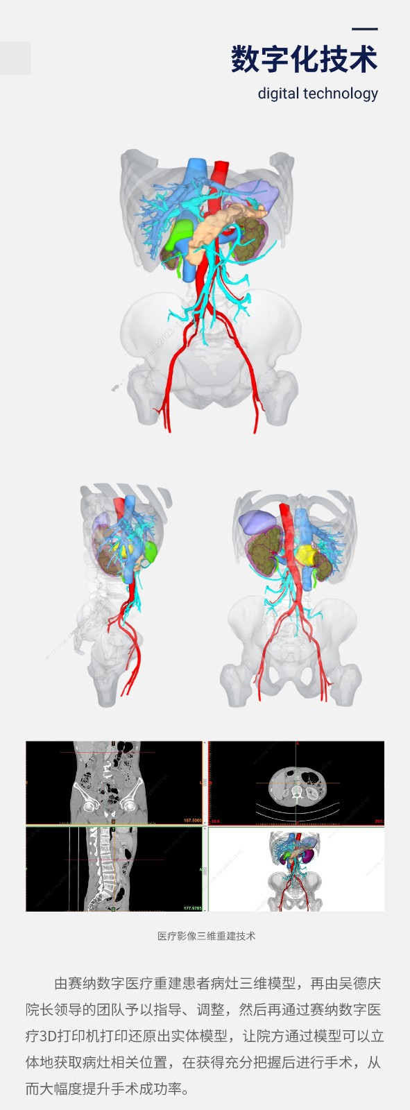 医疗影像三维重建技术.jpg