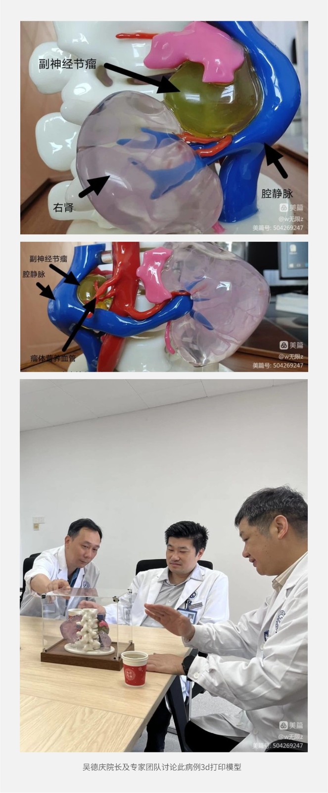 医疗3D打印模型.jpg