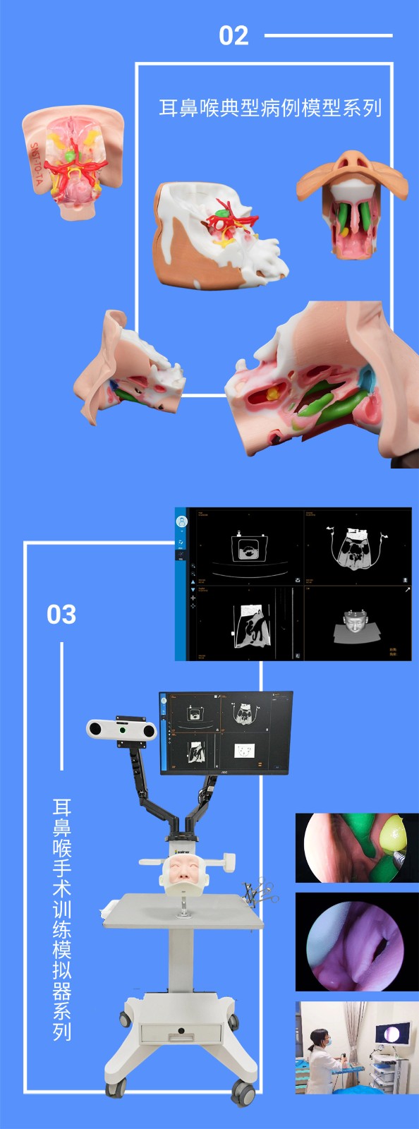 耳鼻喉典型病例模型.jpg